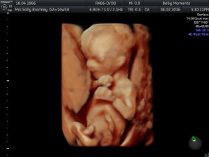 14 weeks baby scan